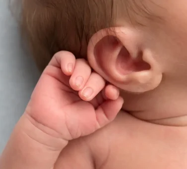 کم شنوایی در نوزادان و هر آنچه در مورد آن باید بدانید